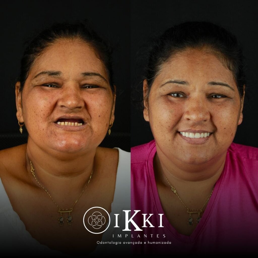 02 - ANTES E DEPOIS - 27.05