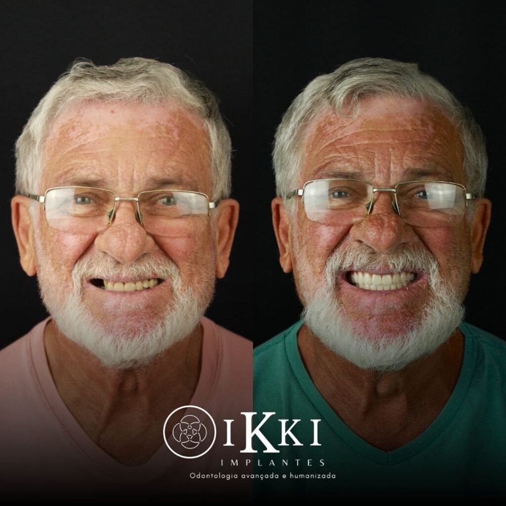 03 - ANTES E DEPOIS - 27.05