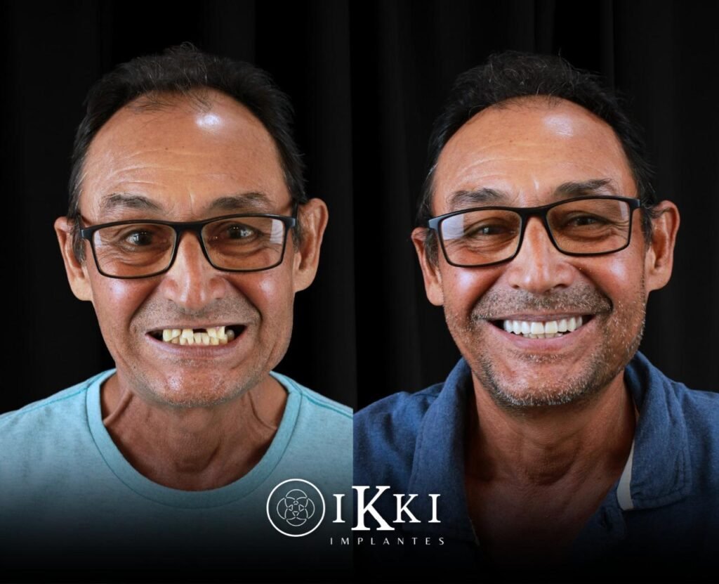 05 - ANTES E DEPOIS - 27.05