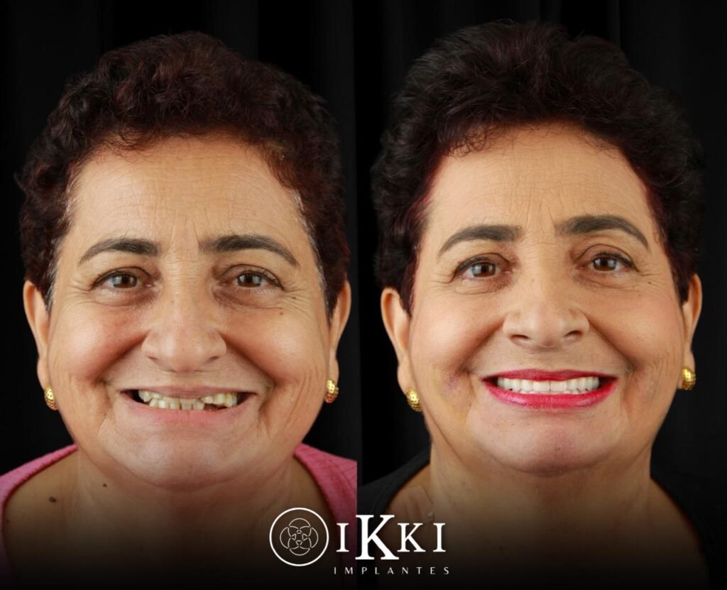 08 - ANTES E DEPOIS - 27.05