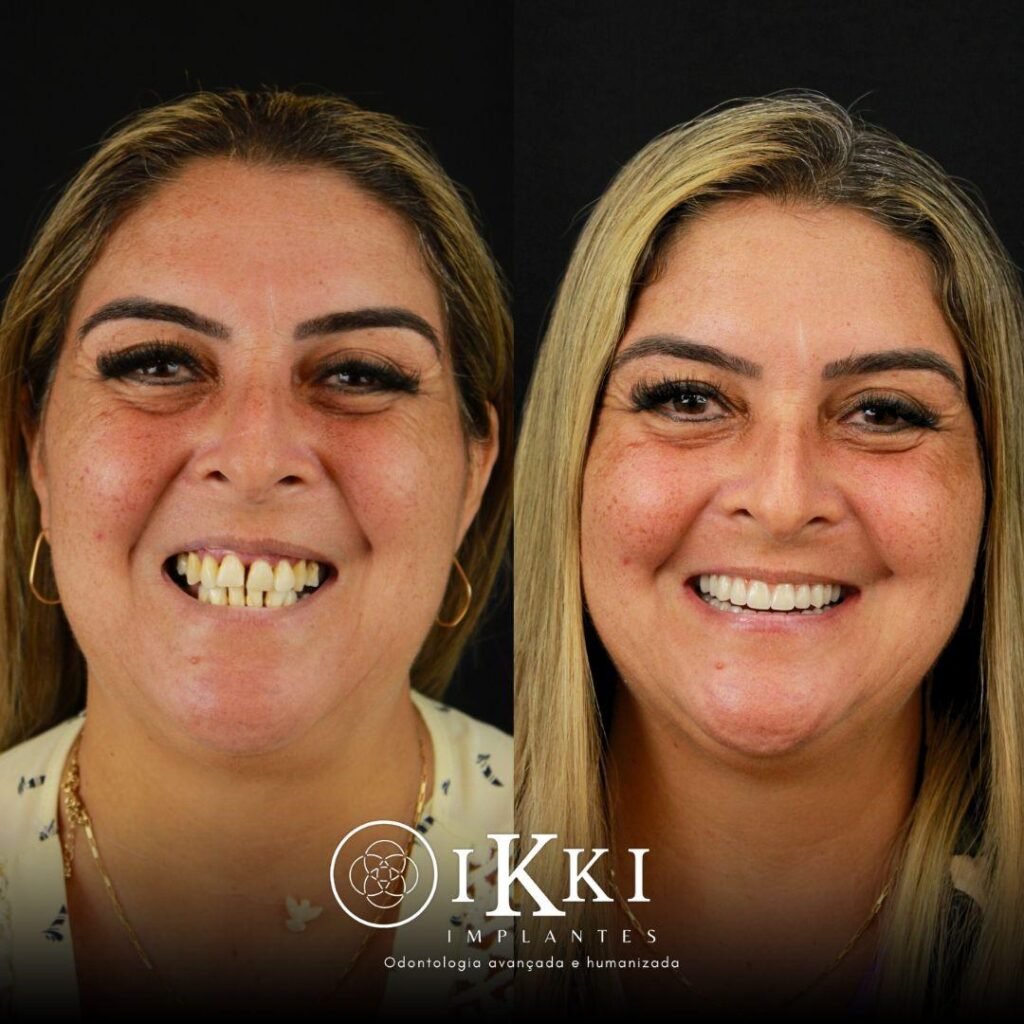 10 - ANTES E DEPOIS - 27.05