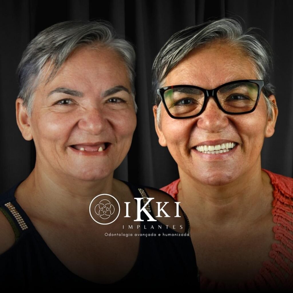 22 - ANTES E DEPOIS - 03.09